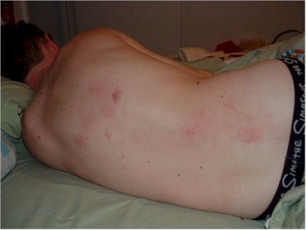 back